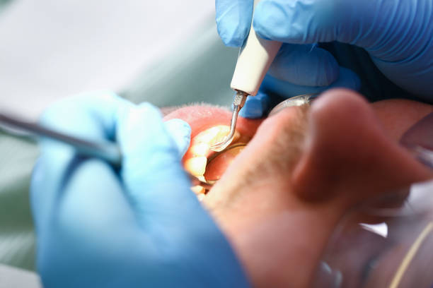 Best Emergency Dental Care for Broken or Chipped Teeth in Hobart, WI